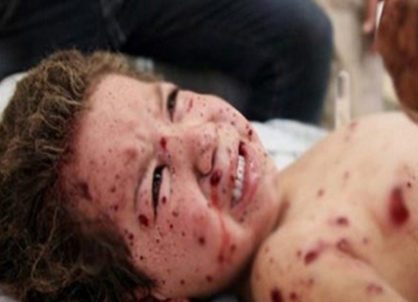 Kana Doymayan İsrail Çocukları Hedef Aldı.